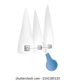 Vector isolated illustration with teeth fixed by bracket system and toothbrush, brush for teeth with braces. Concept of orthodontics, dental care. It can be used in posters, banners, web design, etc.