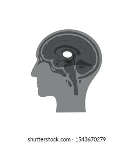 Vector isolated illustration of Thalamus in man head. Human brain components detailed anatomy. Medical infographics for poster, educational, science and medical use. Sagittal view of the brain