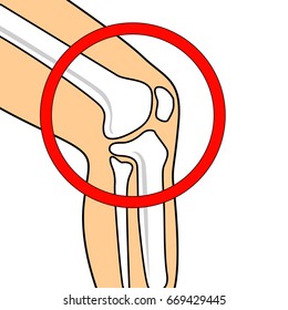 Vector knee joint in a circle