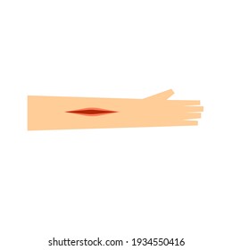 Vector de la herida de laceración en el brazo.