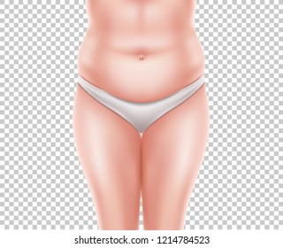 Vector liposuction surgery concept with naked woman body before the operation. Fat obese cellulite and overweight belly area hips before medical transformation for clinic poster transparent background