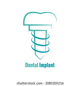 Vector logo dental clinic dental implant. Isolated icon. 