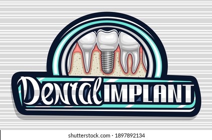 Vector logo for Dental Implant Clinic, dark decorative sign board with illustration of porcelain molar with screw, unique calligraphy lettering for words dental implant for professional denture clinic