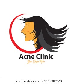 Vector logo design for Clinic Acne skin care. Face woman beautiful. Beauty care treatment Can be used for topics spa, salon, skincare, cosmetology, dermatology, etc. Simple template and easy to use.
