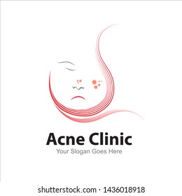 Vector Logo design for Clinic Acne skin care. Face woman beautiful, magnifier, examining. Beauty care facial treatment. Simple template and easy to use.