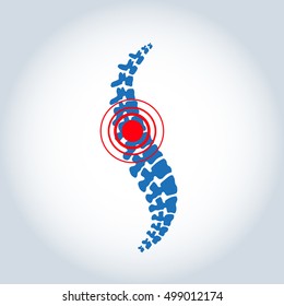 Vector logo template. Human spine isolated silhouette illustration. Spine pain medical center, clinic, rehabilitation, diagnostic, surgery logo element. Flat modern silhouette illustration. Scoliosis