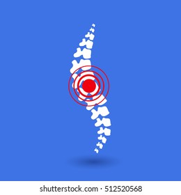 Vector logo template. Human spine isolated silhouette illustration. Spine pain medical center, clinic, rehabilitation, diagnostic, surgery logo element. Flat modern silhouette illustration. Scoliosis