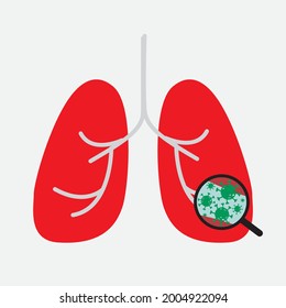 Vector of lungs infected with coronavirus