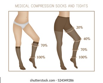 Vector Medical Compression Socks And Tights. Slender And Beautiful Female Legs. Varicose Veins