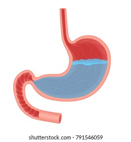 Vector Medical Illustration About Acid In Stomach Isolated. Stomach Acid Reflux, Gastric Acid. Water Fluid.