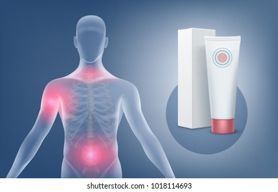 Vector medical illustration of application of the ointment or gel for the treatment of joints pain anatomy arthritis. Tube with packing and silhouette of human body