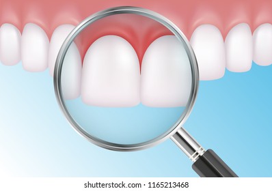 Vector medical illustration of painful teeth with red gums and magnifier on blue background