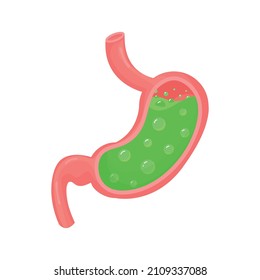 Vektormedizinische Illustration von Magen im Inneren. Kick Bauch. Gastritis und saurer Reflux, Verdauungsstörungen, Erbrechen, Sodbrennen und Magenschmerzen.