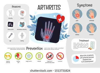 Vector medical poster arthritis. Symptoms of the disease. Prevention. X-ray of the hands.
