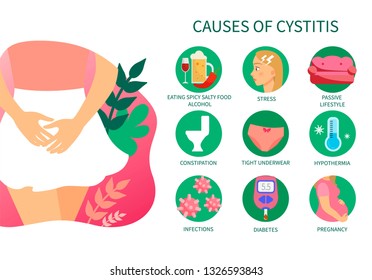 Vector medical poster reasons of cystitis. Diseases of the genitourinary system. Illustration of a girl in a skirt.
