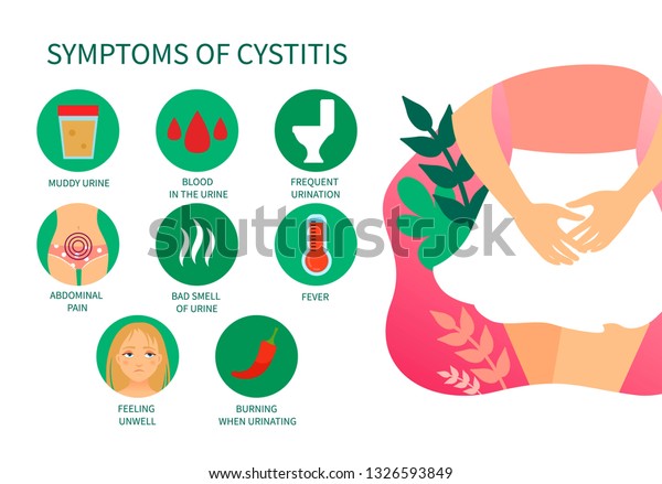 Vector\
medical poster symptoms of cystitis. Diseases of the genitourinary\
system. Illustration of a girl in a\
skirt.\
