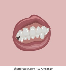 vector of a mouth expression, showing teeth