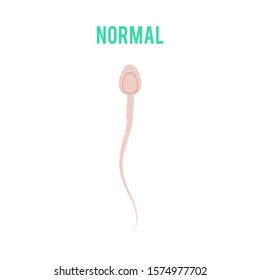 Vector normal spermatozoid motility or movement concept. Male fertility, healthy semen icon. Reproductive men health, medical fertilization design element.