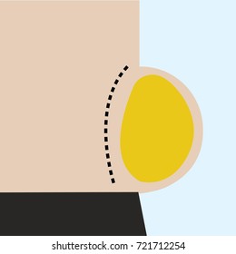vector of obease belly with yellow fat inside