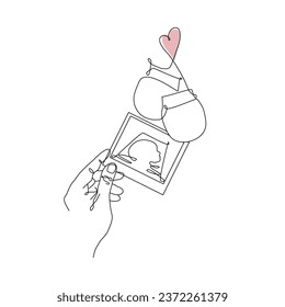 Vector one line art illustration of mother's hands holding a Fetal ultrasound and baby`s bootees. Lineart family portret of new born baby