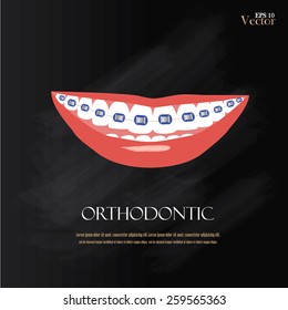 vector orthodontics sign on chalkboard.teeth with braces.vector illustration