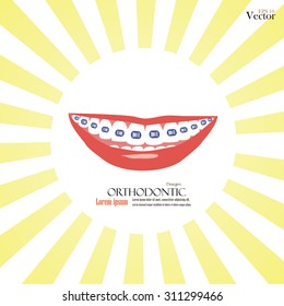 vector orthodontics sign on sunburst background.teeth with braces.vector illustration.