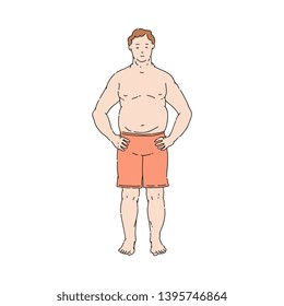 Vector overweight obese unhappy man standing topless in shorts. Fat male character with obesity. Excessive weight man. Health problems connected with weight. Isolated illustration