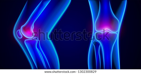 1,980 X Ray Knee Stock Vectors, Images & Vector Art | Shutterstock