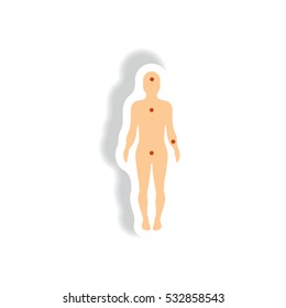 Vector paper sticker various symptoms of leukemia on the human