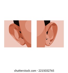vector parts of the human ear
