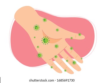 Vektorillustration zeigt Virus auf der Hand, schmutzige Hand, Coronavirus, COVID-19-Infektion