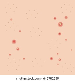 Vector Of Pimple Face Background