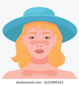 Vector portrait of a woman with sunburn on her face and body. Flat design, minimal style. Useful for skin care, UV protection, summer and health topics.