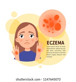 Afiche del vector. Eczema. Triste linda chica. Enfermedad de la piel.