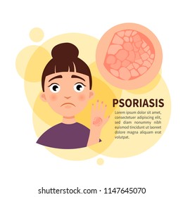 Vector Poster. Psoriasis. Sad Cute Girl. Disease Of The Skin.
