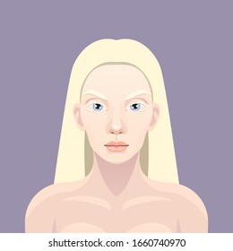 Vector pretty albino girl portrait, blondy hair, albinism, genetic rare disorder