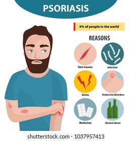 19,493 Psoriasis Images, Stock Photos & Vectors | Shutterstock