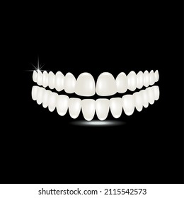 Vector realista, dentaduras 3D. Ilustración de dientes sobre fondo negro. El concepto de diseño de productos impresos para odontología.