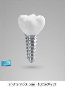 Vector realistic dental implant isolated on gray background. Element for design.