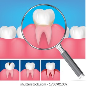 Vector realistic healthy teeth with magnifying glass showing tooth in gums with roots visible