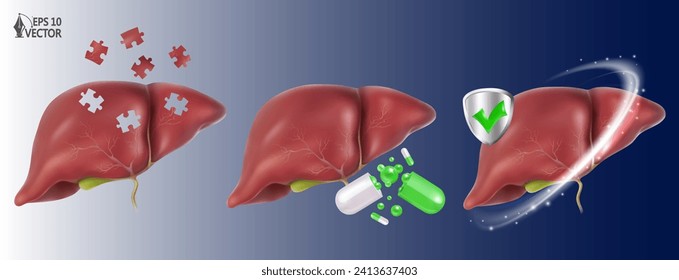 Vector realistic human liver, anatomically correct structure model. Hepatic system, digestive gallbladder organ. 3D illustration set for medical drugs, pharmacy and education design