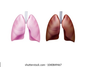 Vector realistic pink healthy and brown diseased lungs lung with trachea close up front view isolated on white background