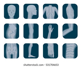 Vector realistic X-ray skeleton icons set. Human Skeleton xray elements. Body parts icon