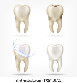 Vector set of 3d realistic clean and dirty tooth , clearing tooth process. Oral Care, teeth restoration