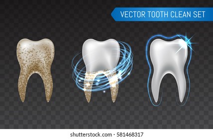 Vector set of 3d realistic clean and dirty tooth isolated on transparent background, clearing tooth process. Teeth Whitening. Dental health Concept. Oral Care, teeth restoration