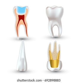 Vector set of 3d realistic clean and dirty tooth isolated on white background. Dental health Concept. Oral Care, teeth restoration