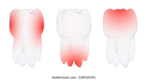 vector set of 3d teeth on a white background. toothache.