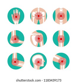 Vector Set Of Human Joints With Pain Rings. Disease In Bone, Knee, Leg, Pelvis, Scapula, Skull, Elbow, Foot And Hand Illustration. Arthritis And Rheumatism Icons.