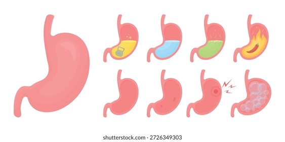 Conjunto de Vector de estómago humano con diferentes condiciones de salud. Estómago sano, pesadez, hinchazón, úlcera, dolor, alta acidez con ácido verde, acidez estomacal y estómago con agua. Concepto de sistema digestivo médico, problemas de gastroenterología y tratamiento. Ilustración moderna plana aislada sobre fondo blanco.