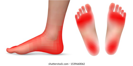vector set of legs with red patches of pain on a white background
